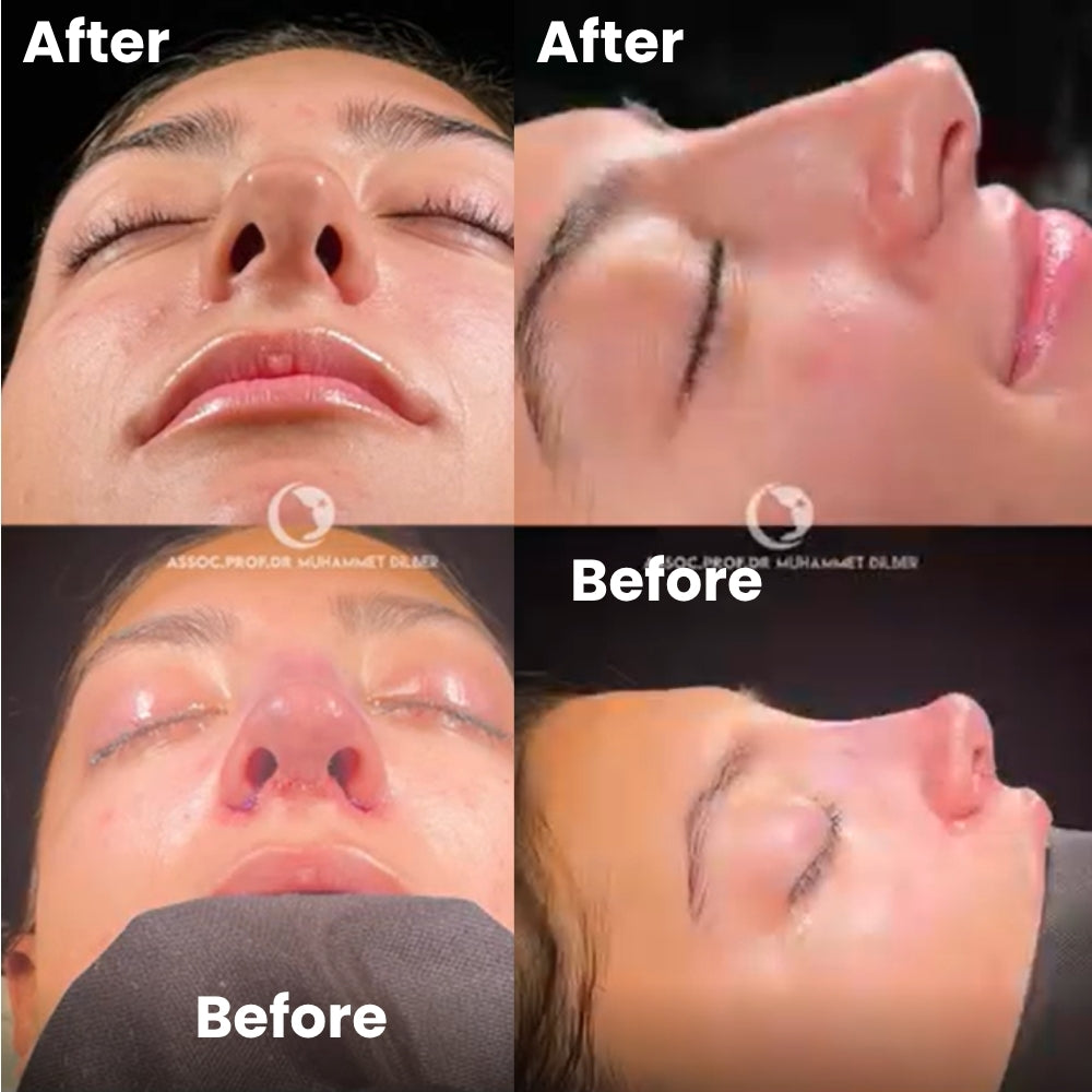 MAAS Sinus Rinse Bottle™